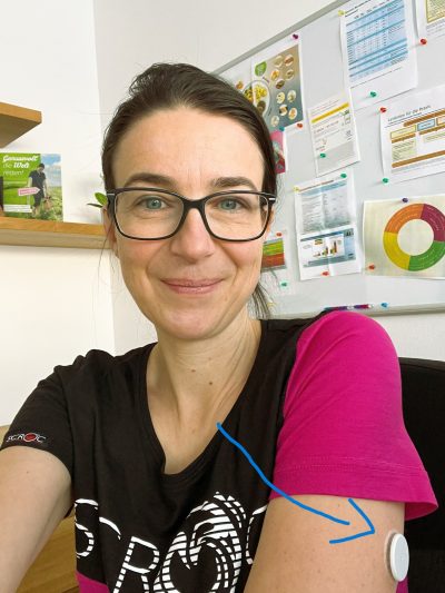 Andrea Kasper-Füchsl beim Tragen eines Glucosesensors